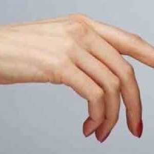 Hladno roke ženske so naravni dejavnik!