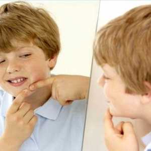 Kako se znebiti aken na obrazu najstnik