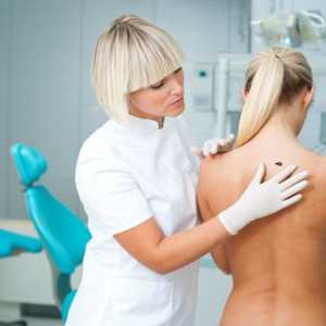 Kako prepoznati in zdraviti melanom hrbtenico