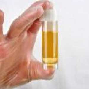 Kako opraviti test urina med nosečnostjo?