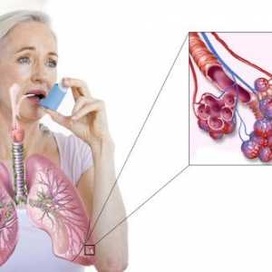Kako ozdraviti astme