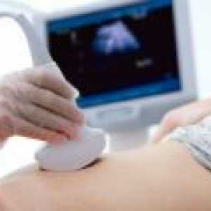 Kdaj prvi ultrazvok v nosečnosti?