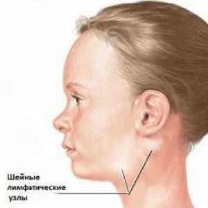 Materničnega vratu limfadenitis