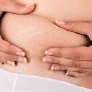 Olje za strij med nosečnostjo doma