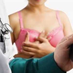 Mastektomiji - operacija za odstranitev prsi