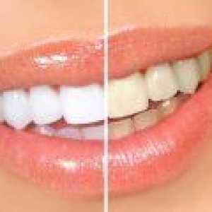 Ali je možno beljenje zob doma? Najbolj priljubljena metode