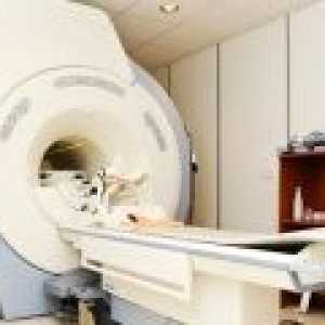 MRI možganov