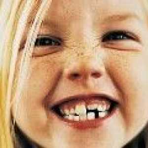 Malocclusion zob