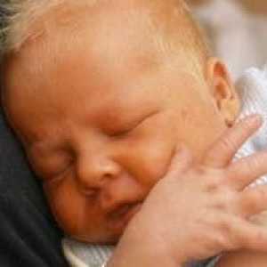 Norma bilirubin pri novorojenčkih
