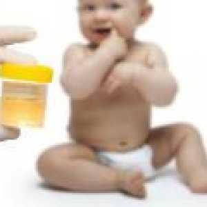 Norme urina pri odraslih, pri otrocih