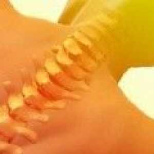 Torakalne hrbtenice osteohondroza