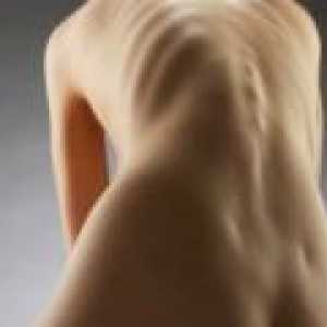 Osteoporoza z ženskami: Simptomi in zdravljenje