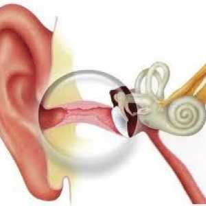 Akutno vnetje srednjega ušesa - v povprečju, gnojen, katarju, akutno vnetje srednjega ušesa pri…