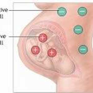 Negativen Rh faktor v nosečnosti