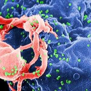 Prvi simptomi HIV