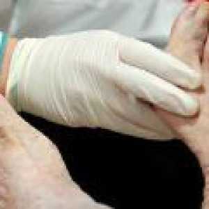 Polinevropatija spodnjih udov: simptomi, zdravljenje