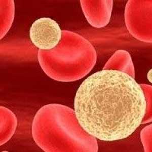 Nizek krvni levkociti: Vzroki in zdravljenje