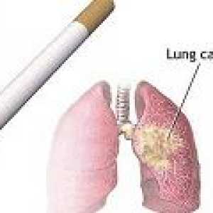 Vzroki za pljučnega raka pri kadilcih