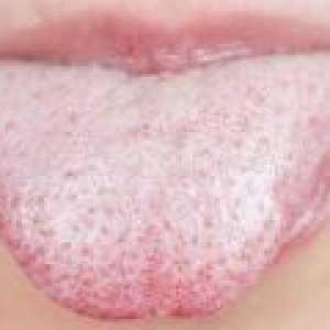 Vzroki suhih ust in prevleko jezika
