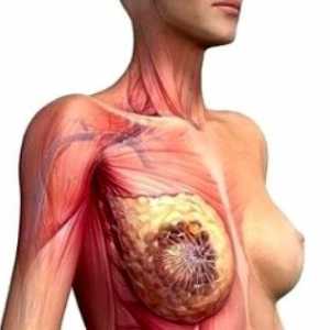 Znaki raka pri ženskah prsnice