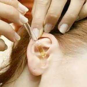 Mozolj na uho: glavni vzroki in zdravljenje