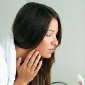 Mozolji na licih in pod ličnice: vzroki in priporočila za zdravljenje