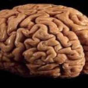Možgani rak - vzroki, diagnoza, prognoza
