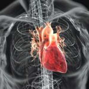 Srce revmatizem