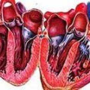 Simptomi in zdravljenje alkoholne kardiomiopatije