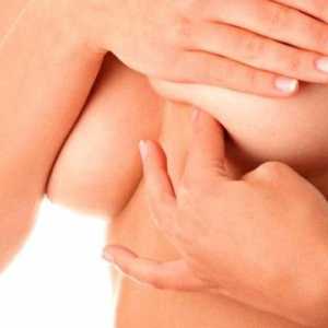 Simptomi in zdravljenje mastitisa pri doječih materah