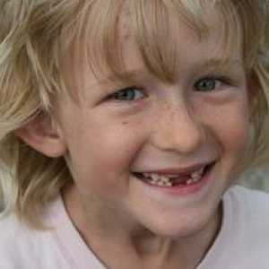 Zamenjava zob pri otrocih