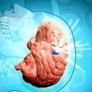 Subduralni hematom na možganih: vzroki, simptomi, zdravljenje