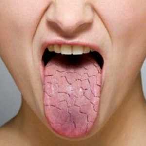 Suha usta - povzroča bolezen