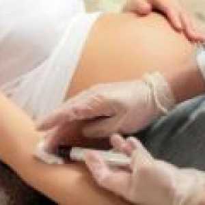 Strjevanje krvi med nosečnostjo, stopnja patologije