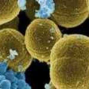 Tamoksifen mogoče boriti tudi s Staphylococcus aureus