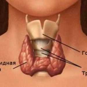 Hashimotov tiroiditis (Hashimotov tiroiditis) - vzroki, simptomi in zdravljenje