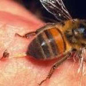 Sting iz čebele, ose, Hornet: Zdravljenje