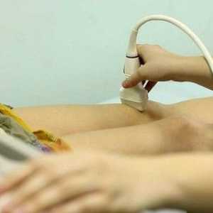 Žilni ultrazvok: kaj se dogaja in kaj potrebujete