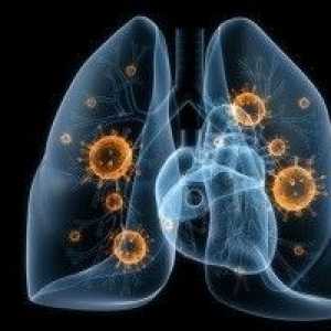 Virusna pljučnica - vzroki, simptomi, diagnosticiranje in zdravljenje