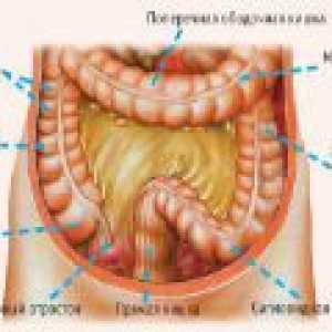 Vnetje sigmoidno debelega črevesa: Simptomi in zdravljenje